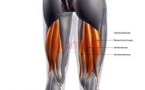 cara mengobati cedera hamstring