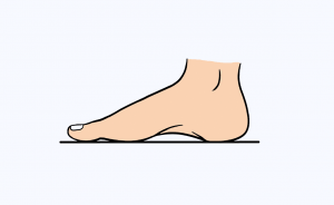 nyeri pada punggung kaki kanan
