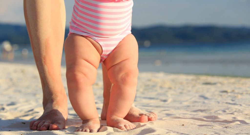 kaki bayi bengkok