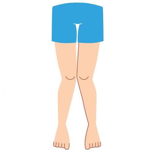 bentuk kaki x patella