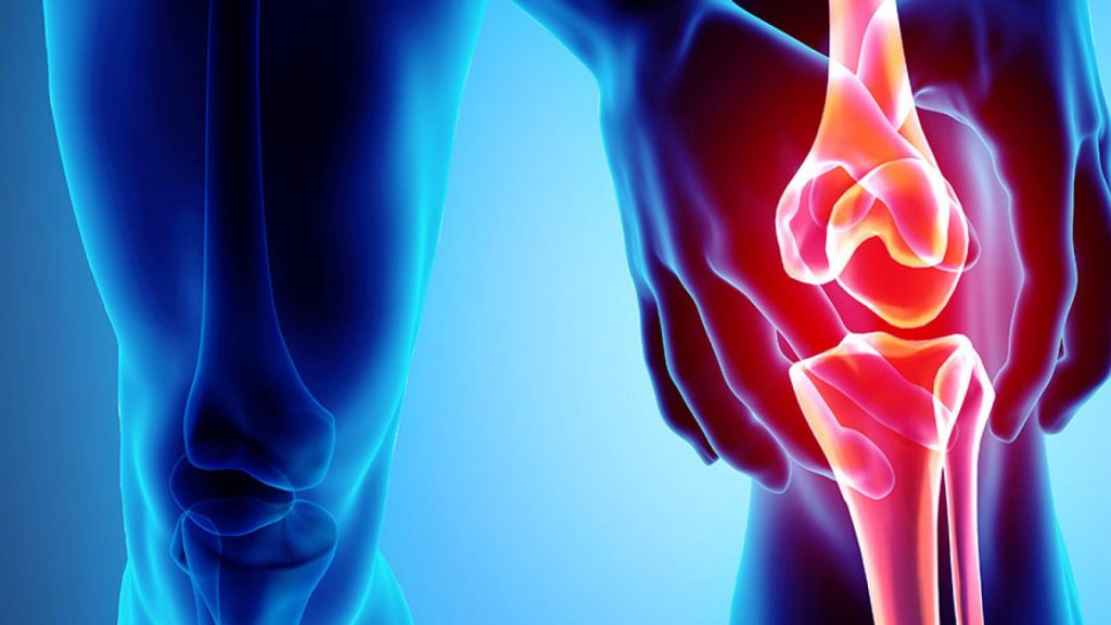 KNEE PAIN