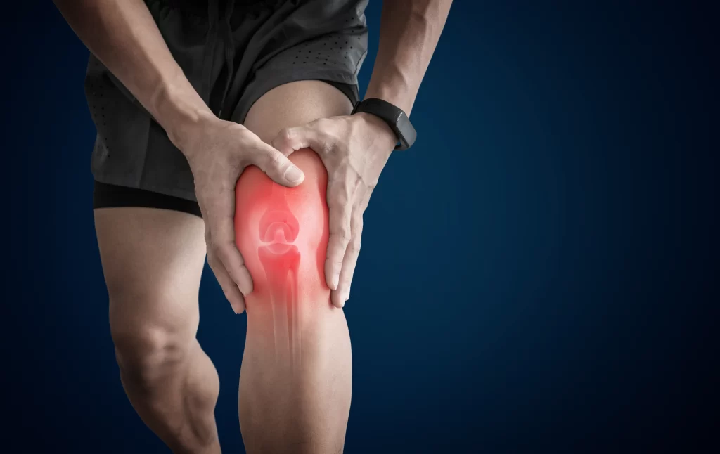 Penyebab Taji Tulang - Patella