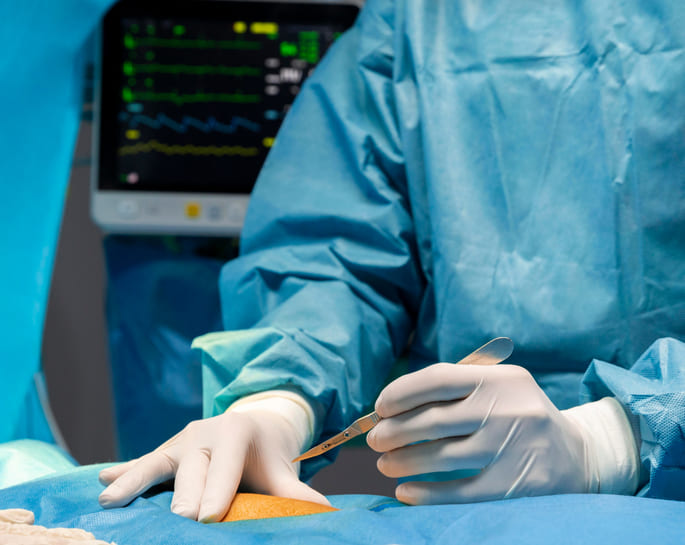 arthroscopy