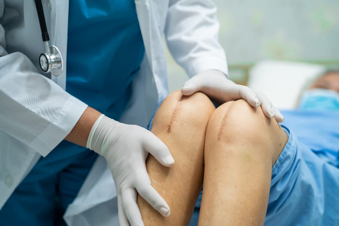 patellar realignment