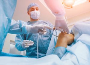 risiko arthroscopy yang perlu dipertimbangkan